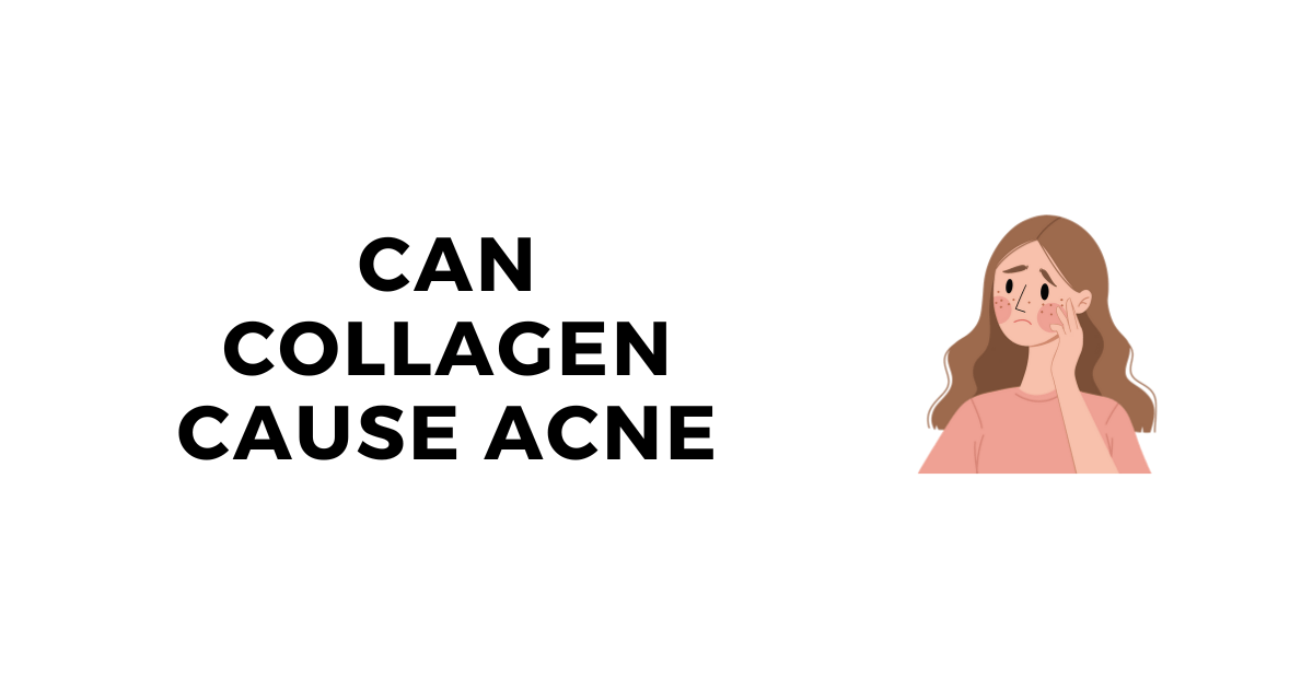 Can Collagen Cause Acne? The Best Way to Avoid It - Supplement or Powd